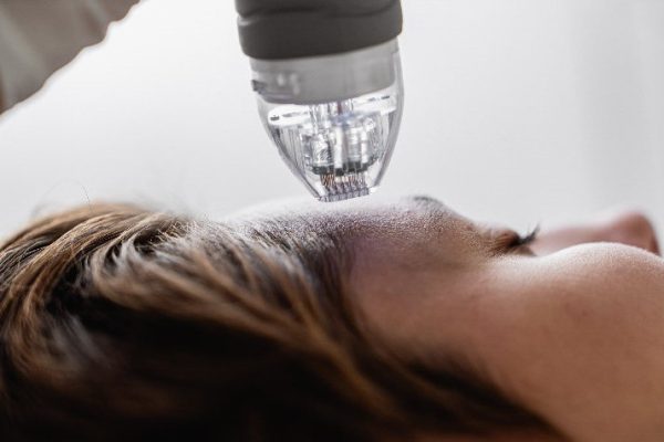 Ästhetic By Semra RF Microneedling